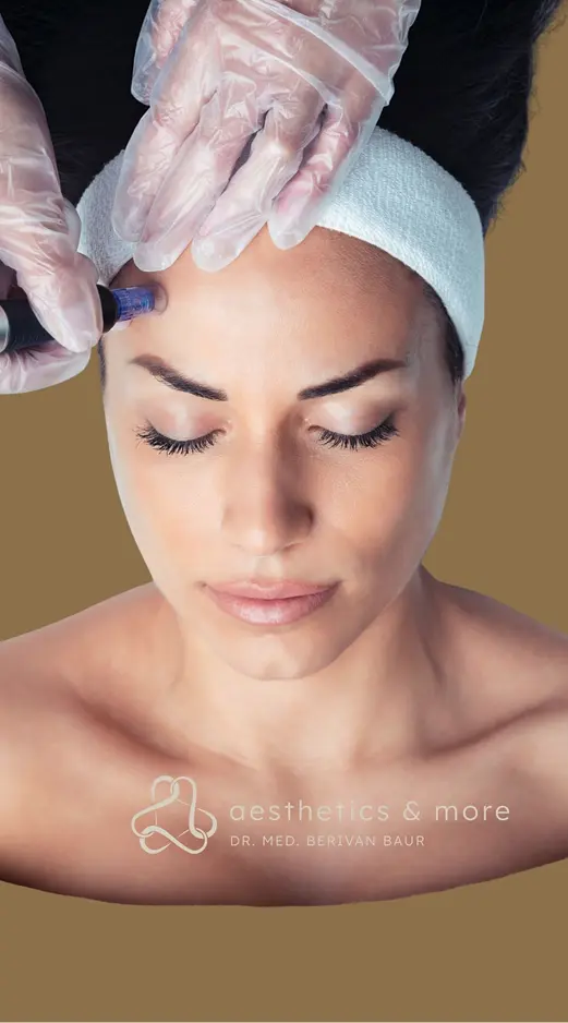 251209 Microneedling